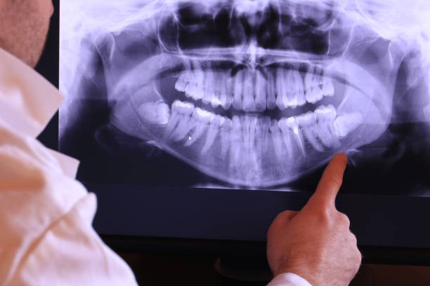 Best Emergency Gum Treatment in Port Huron, MI