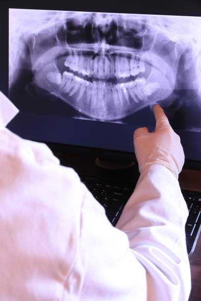 Best Emergency Treatment for Dental Infections or Abscesses in Port Huron, MI