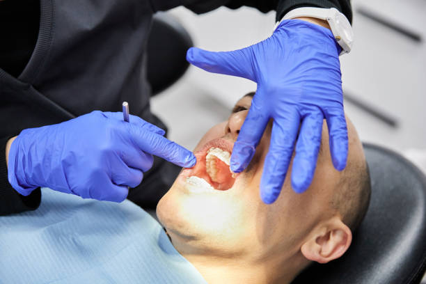 Best Emergency Wisdom Teeth Removal in Port Huron, MI